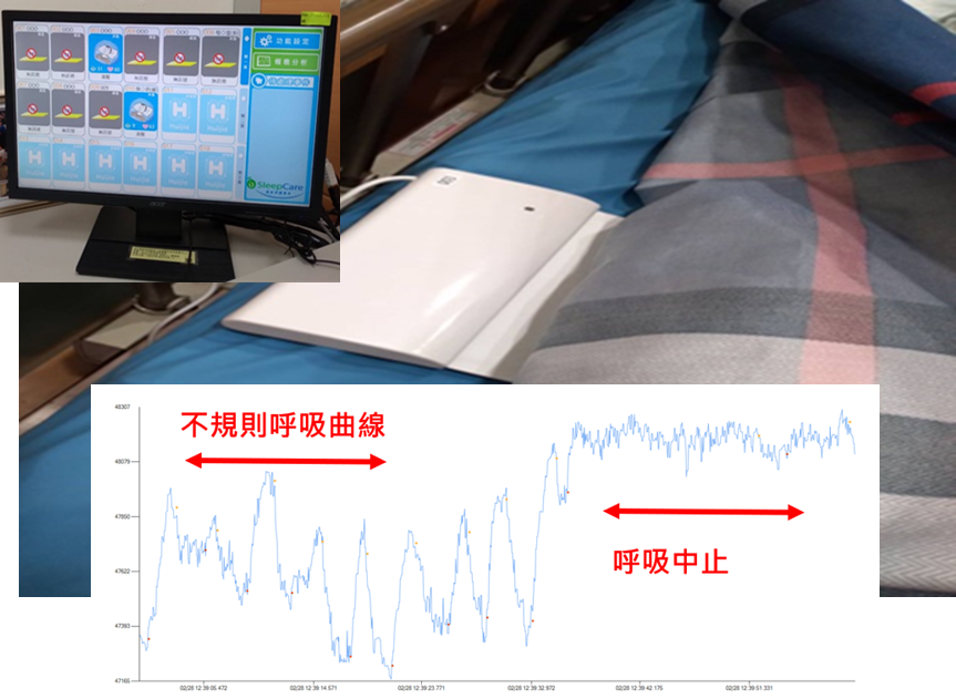 圖二、智慧床墊監測臨終病人呼吸型態
