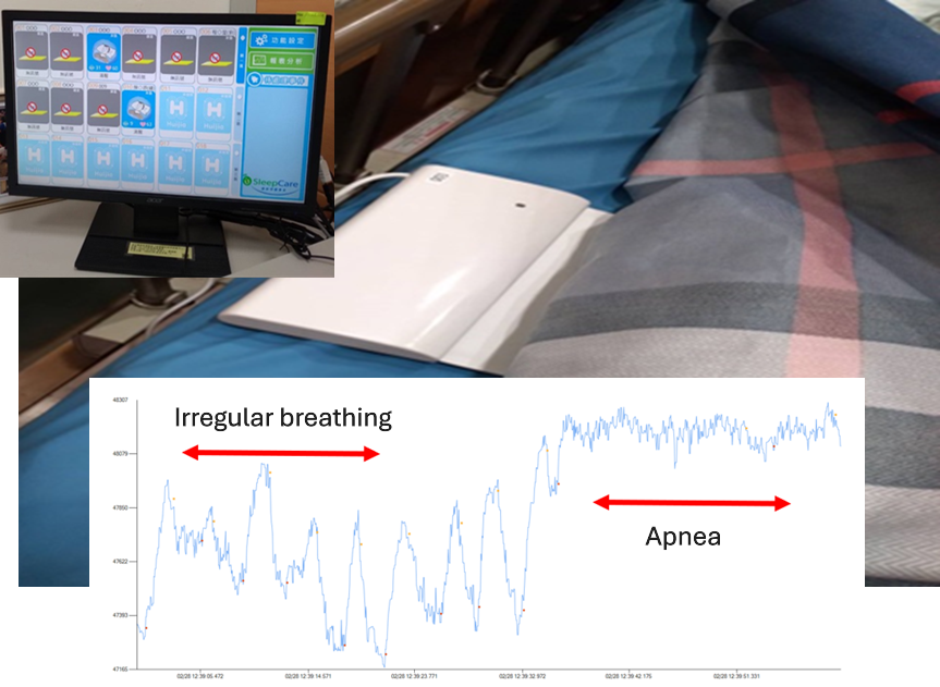 Figure 2. A smart mattress to detect changes in respiratory rate