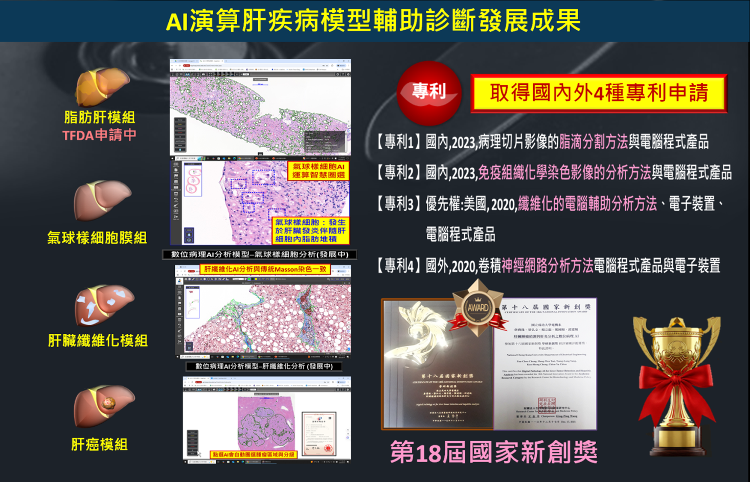 圖二、AI演算肝疾病模型輔助診斷發展成果