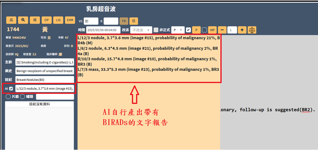 圖二、AI影像輔助判讀與報告整合畫面:AI自動分析乳房影像並產生評分(Score)與熱區圖,將結果整合至RIS報告平台,協助醫師快速判讀。